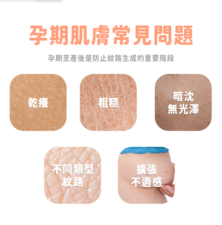 孕媽咪水感撫紋霜